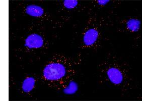 Proximity Ligation Analysis of protein-protein interactions between PDGFRB and PLCG1. (Phospholipase C gamma 1 抗体  (AA 1192-1291))