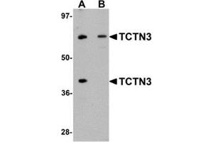 Western blot analysis of TCTN3 in HeLa cell lysate with TCTN3 antibody at (A) 1 and (B) 2 μg/ml. (TCTN3 抗体  (C-Term))