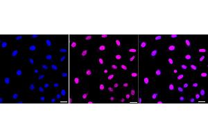 Immunocytochemical staining of HepG2 cells with Phospho-JunD (S255) antibody (ABIN7799144), 1:1,000). (Recombinant JunD 抗体  (pSer255))