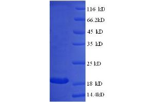Interferon, alpha 14 (IFNa14) (AA 24-189) protein (GST tag)