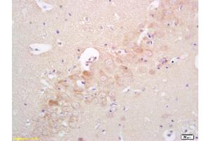 Formalin-fixed and paraffin embedded rat brain labeled with Rabbit Anti phospho-IRAK4(Thr345)Polyclonal Antibody, Unconjugated (ABIN753538) at 1:200 followed by conjugation to the secondary antibody and DAB staining (IRAK4 抗体  (pThr345))