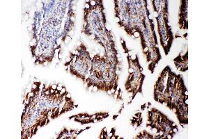 Anti-RGS3 antibody, IHC(P) IHC(P): Rat Intestine Tissue