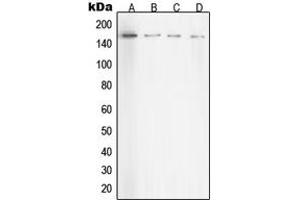 Western blot analysis of ROCK1 expression in HeLa (A), NIH3T3 (B), C6 (C), COS7 (D) whole cell lysates.