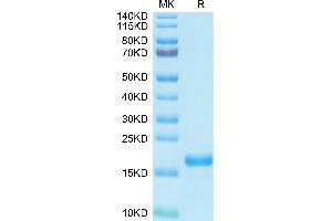 SDS-PAGE (SDS) image for SARS-CoV-2 Nucleocapsid (SARS-CoV-2 N) (AA 64-180) protein (His-Avi Tag) (ABIN7275373)