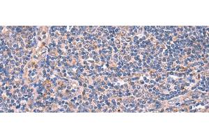Immunohistochemistry of paraffin-embedded Human tonsil tissue using MPP1 Polyclonal Antibody at dilution of 1:50(x200) (MPP1 抗体)