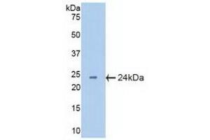 Detection of Recombinant CRYbB2, Mouse using Polyclonal Antibody to Crystallin Beta B2 (CRYbB2) (CRYbB2 抗体  (AA 17-191))