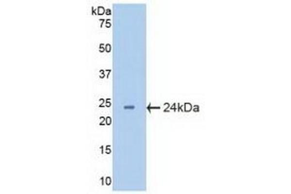 CRYbB2 抗体  (AA 17-191)