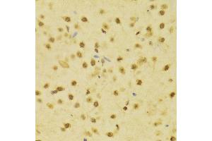 Immunohistochemistry of paraffin-embedded Rat brain using RBFOX3 antibody at dilution of 1:100 (x400 lens). (NeuN 抗体)