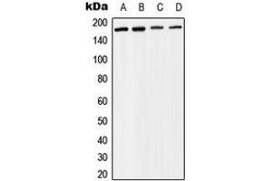 Western blot analysis of BAF170 expression in Raji (A), MCF7 (B), mouse liver (C), rat liver (D) whole cell lysates. (SMARCC2 抗体  (Center))