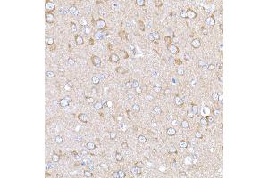 Immunohistochemistry (IHC) image for anti-Melanoma Antigen Family D, 1 (MAGED1) (AA 635-834) antibody (ABIN3021415)
