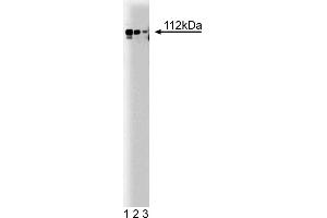 Western Blotting (WB) image for anti-Adaptor-Related Protein Complex 2, alpha 1 Subunit (AP2A1) (AA 38-215) antibody (ABIN968009) (alpha Adaptin 抗体  (AA 38-215))
