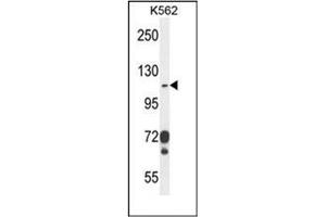 Western blot analysis of CD103 Antibody (C-term) in K562 cell line lysates (35ug/lane). (CD103 抗体  (C-Term))