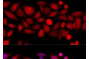 Immunofluorescence (IF) image for anti-Kinesin Family Member 4A (KIF4A) antibody (ABIN7255191)