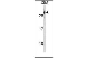 Western blot analysis of RGS5 Antibody (N-term) in CEM cell line lysates (35ug/lane). (RGS5 抗体  (N-Term))
