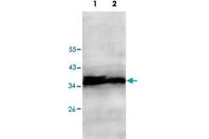 Western blot analysis of HepG2 (Lane 1) and Jurkat (Lane 2) cell lysate with ECH1 polyclonal antibody  at 1 : 500 dilution. (ECH1 抗体  (AA 145-325))