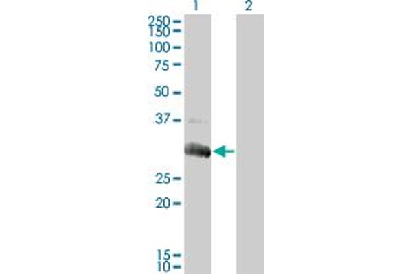 Deoxyguanosine Kinase 抗体  (AA 1-89)