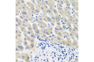 Immunohistochemistry of paraffin-embedded human liver injury using HSD11B2 antibody at dilution of 1:100 (x40 lens). (HSD11B2 抗体)