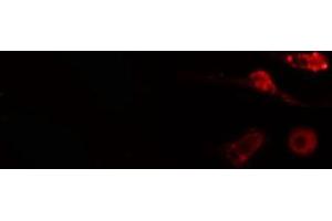 ABIN6275036 staining  COLO205 cells by IF/ICC. (NCAPH 抗体  (Internal Region))