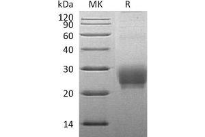 Western Blotting (WB) image for Tumor Necrosis Factor (Ligand) Superfamily, Member 4 (TNFSF4) protein (His tag) (ABIN7320960) (TNFSF4 Protein (His tag))