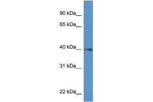 Western Blot showing PTGDR antibody used at a concentration of 1 ug/ml against Hela Cell Lysate (PTGDR 抗体  (C-Term))