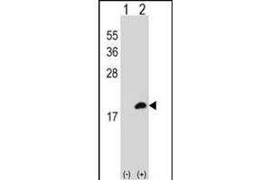Western blot analysis of COTL1 (arrow) using rabbit polyclonal COTL1 Antibody (C-term) (ABIN652766 and ABIN2842503). (COTL1 抗体  (C-Term))