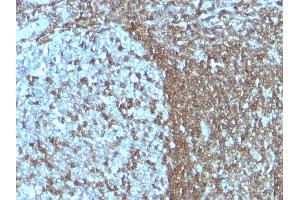 Formalin-fixed, paraffin-embedded human Tonsil stained with CD50 Monoclonal Antibody (SPM505) (ICAM-3/CD50 抗体)