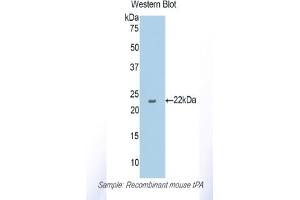 Detection of Recombinant tPA, Mouse using Polyclonal Antibody to Tissue Plasminogen Activator (tPA) (PLAT 抗体  (AA 359-532))