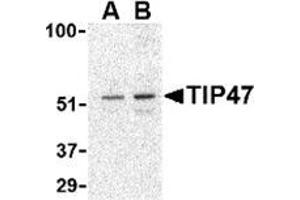 Western blot analysis of TIP47 in Daudi cell lysate with this product at (A) 0. (PLIN3 抗体  (C-Term))