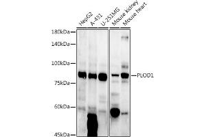 Western blot analysis of extracts of various cell lines, using PLOD1 antibody (ABIN6127272, ABIN6145784, ABIN6145786 and ABIN6223913) at 1:1000 dilution. (PLOD1 抗体  (AA 488-727))