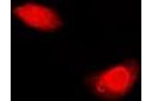 Immunofluorescent analysis of Periplakin staining in U2OS cells. (PPL 抗体)