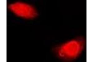 Immunofluorescent analysis of Periplakin staining in U2OS cells. (PPL 抗体)