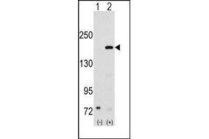 Western blot analysis of SRC1 (arrow) using rabbit polyclonal SRC1 Antibody (NCOA1 抗体  (N-Term))