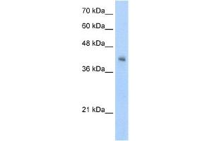 WB Suggested Anti-VSIG4 Antibody Titration:  5.