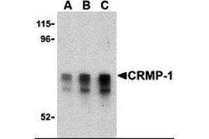 Western Blotting (WB) image for anti-Collapsin Response Mediator Protein 1 (CRMP1) (Middle Region) antibody (ABIN1030908) (CRMP1 抗体  (Middle Region))