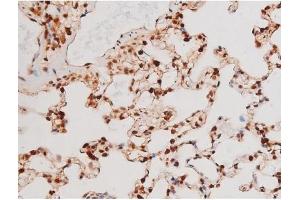 Immunohistochemistry (IHC) image for anti-Signal Transducer and Activator of Transcription 3 (Acute-Phase Response Factor) (STAT3) (pTyr705) antibody (ABIN6255995)