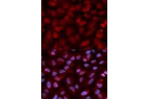 Immunofluorescence (IF) image for anti-CD47 (CD47) (AA 20-140) antibody (ABIN3022624) (CD47 抗体  (AA 20-140))