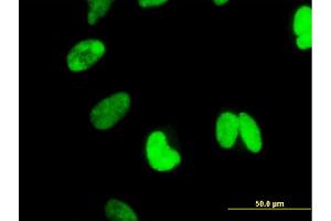 Immunofluorescence (IF) image for anti-Catenin, beta Like 1 (CTNNBL1) (AA 210-311) antibody (ABIN566018)