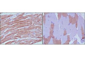 Immunohistochemical analysis of paraffin-embedded human skeletal muscle (left) and cardiac muscle (right) using MYL3 antibody with DAB staining. (MYL3/CMLC1 抗体)
