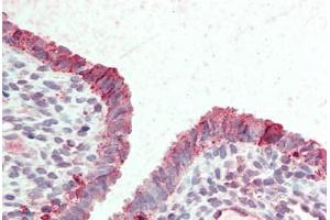 Anti-STEAP2 antibody  ABIN960821 IHC staining of human uterus. (STEAP2 抗体  (Internal Region))