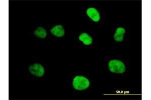 Immunofluorescence of purified MaxPab antibody to MCM4 on HeLa cell. (MCM4 抗体  (AA 1-863))