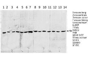 Western Blotting (WB) image for anti-Actin (C-Term) antibody (ABIN3183157)