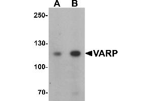 Western blot analysis of VARP in K562 cell lysate with VARP antibody at (A) 1 and (B) 2 µg/mL. (ANKRD27 抗体  (N-Term))