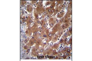 GBA3 Antibody (C-term) (ABIN656223 and ABIN2845539) immunohistochemistry analysis in formalin fixed and paraffin embedded human liver tissue followed by peroxidase conjugation of the secondary antibody and DAB staining. (GBA3 抗体  (C-Term))