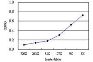 CTH (Human) Matched Antibody Pair