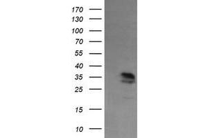 Image no. 2 for anti-Kinesin Family Member 25 (KIF25) antibody (ABIN1499040)
