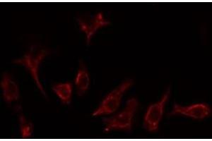 ABIN6276801 staining Hela cells by IF/ICC. (GRK2 抗体  (Internal Region))
