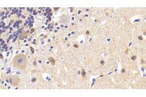 Immunohistochemistry (IHC) image for anti-Microtubule-Associated Protein 2 (MAP2) (AA 727-985) antibody (ABIN7433480)