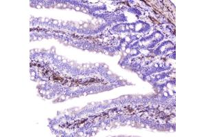 IHC analysis of Hsp27 using anti-Hsp27 antibody (ABIN6719322). (HSP27 抗体  (AA 1-209))