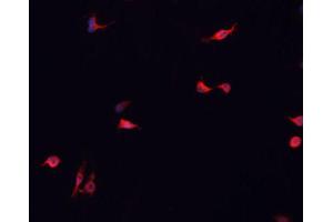 ABIN6266838 staining MCF-7 cells by IF/ICC. (DUSP16 抗体  (Internal Region))