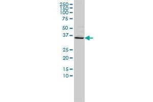 FOXR2 monoclonal antibody (M01), clone 2C1 Western Blot analysis of FOXR2 expression in Hela . (FOXR2 抗体  (AA 1-311))